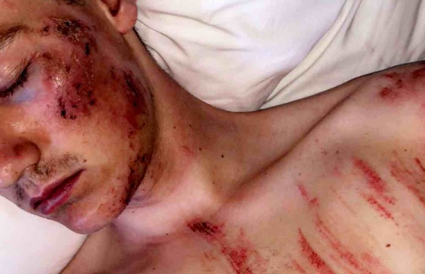 Grave caída de Simon Andreassen probando el circuito de Stellenbosch